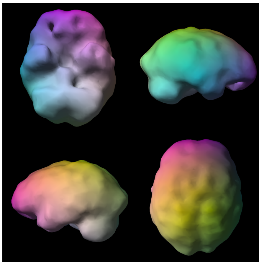 Concentration SPECT surface render — four-view brain montage, on-task state